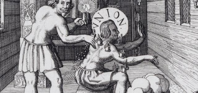 Historische Darstellung des Aderlasses